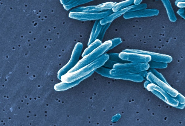 WHO: "Strijd tegen tuberculose bewijst effect, maar er is meer geld nodig"