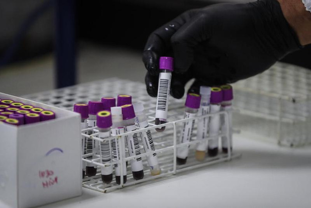 Derde jaar op rij forse stijging hiv-diagnoses